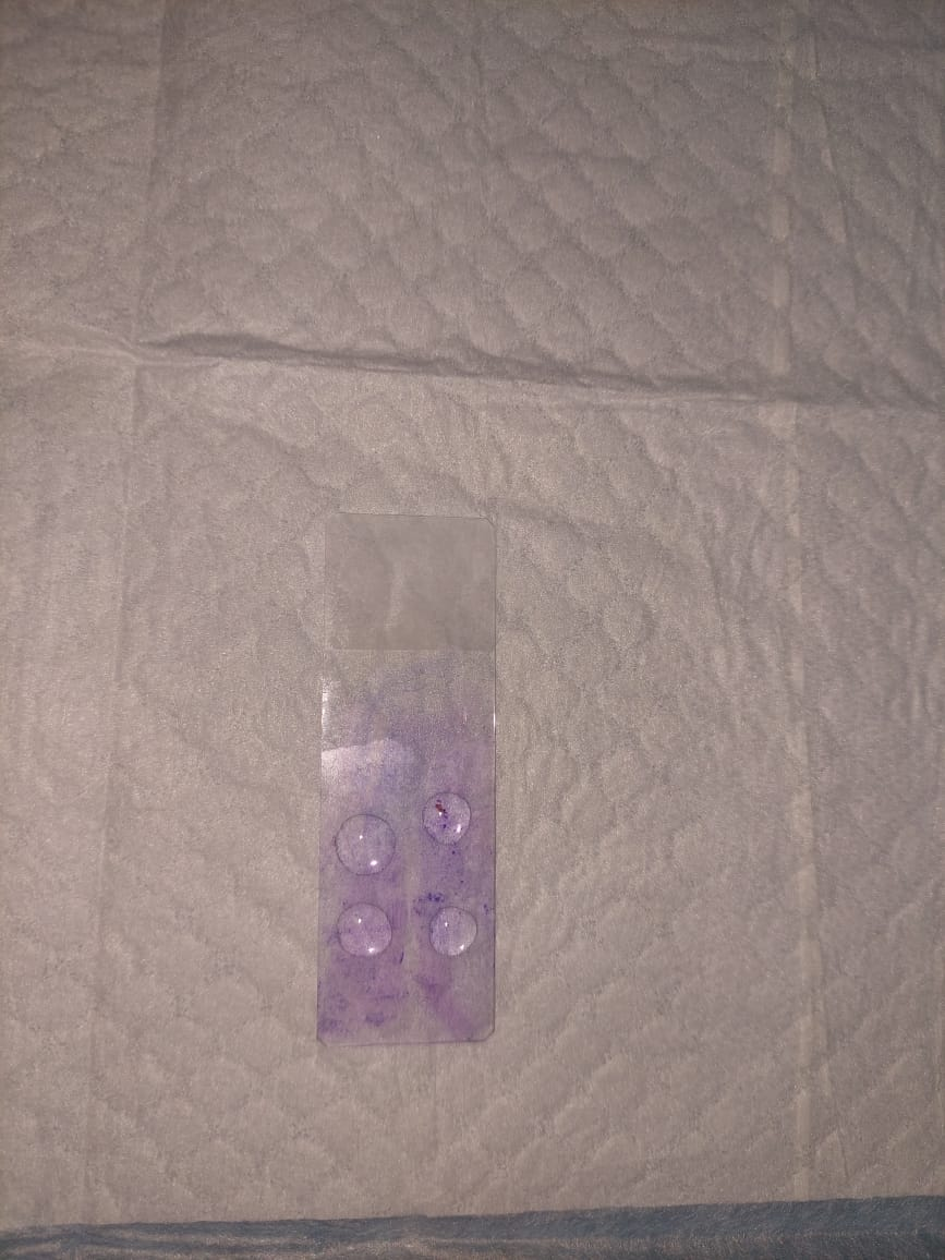 Фото 9. Материал, взятый из наружных слуховых проходов (окрашен и подготовлен к микроскопии).