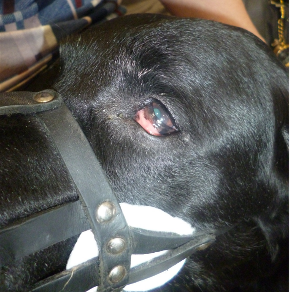 Фото 6. Синдром Хорнера.