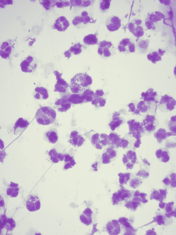 Диагностика пиодермии