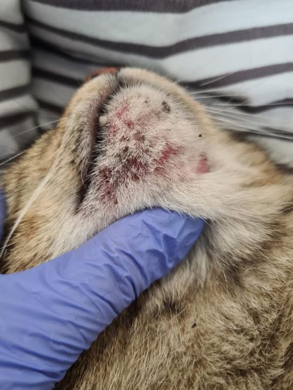 Фото 4. Фурункулез в области подбородка.