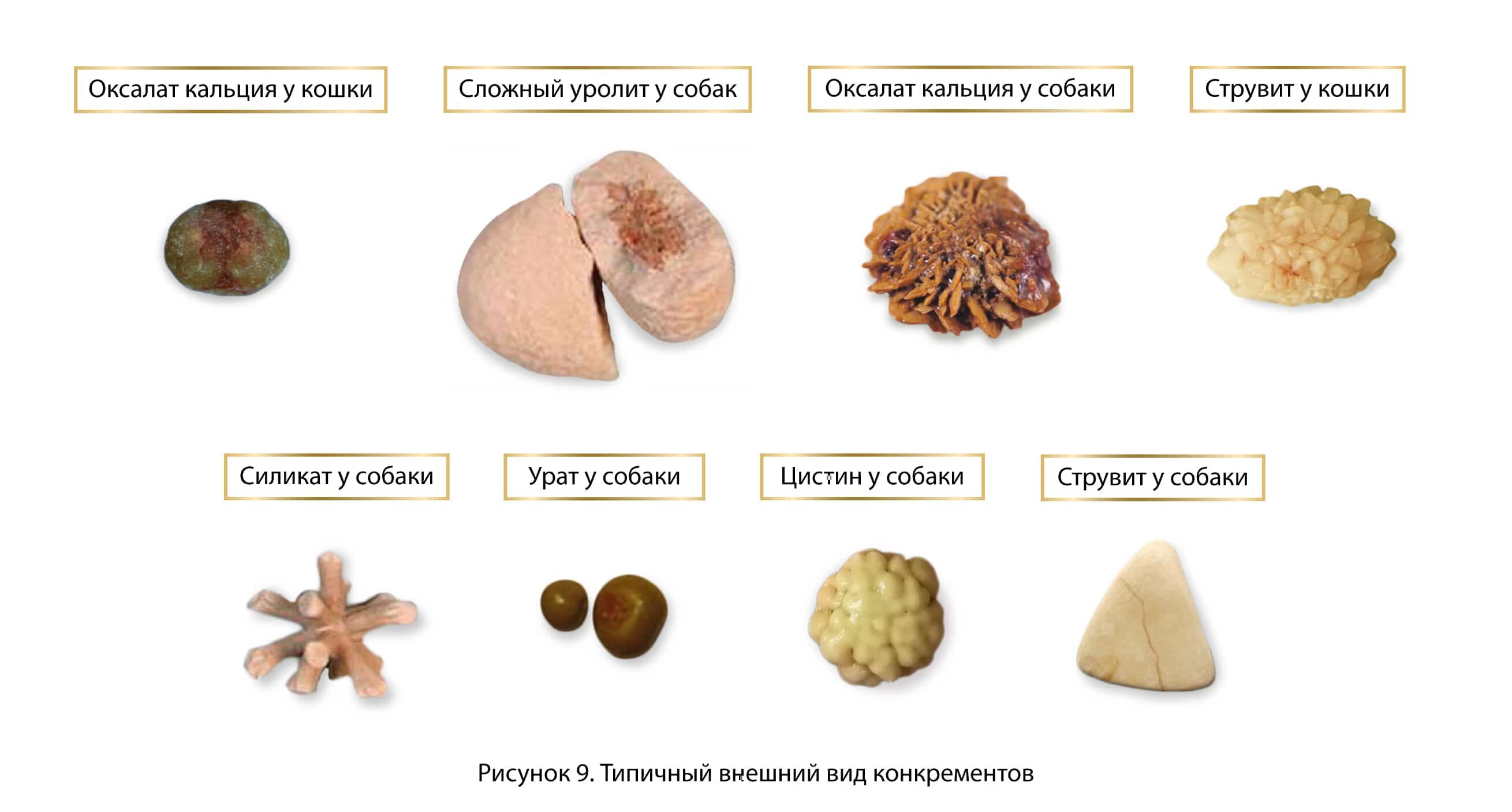 Типичный внешний вид конкрементов