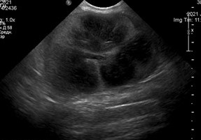 УЗИ кота с подозрением на ХБП (1)
