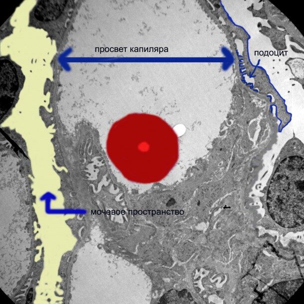 Область капиллярного просвета. Норма. ЭМ х4000