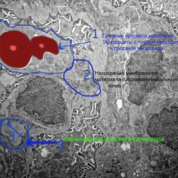 Область капиллярного просвета и мезангия